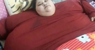 Самая полная женщина в мире за 2 месяца похудела на 242 кг