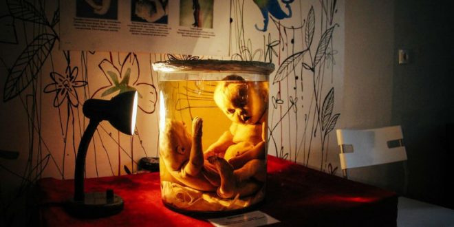 В Новосибирске возле мусорного бака найдена колба с человеческим эмбрионом